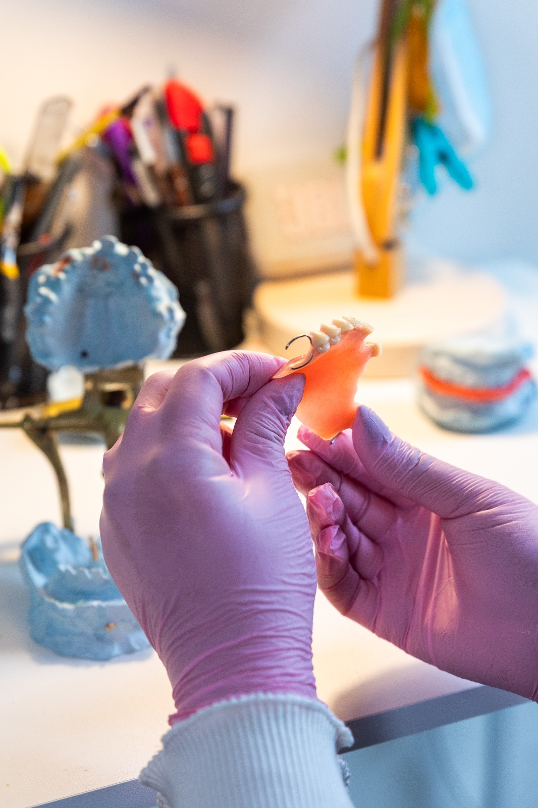 Trabajo de laboratorio dental — prótesis a medida